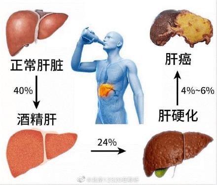 男性肝脏不好，不可忽视的10大症状表现