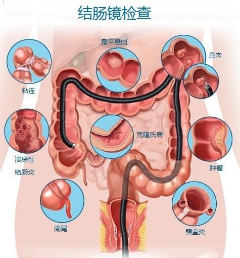 人体解剖学奇趣，结肠与肝脏的邻居关系