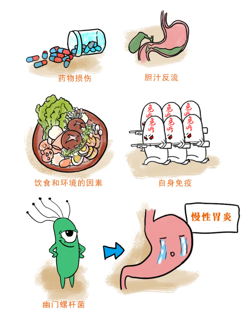 肠胃炎的成因与日常注意事项