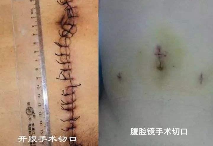 佛山妇科医疗的佼佼者，探寻佛山地区优质妇科医院